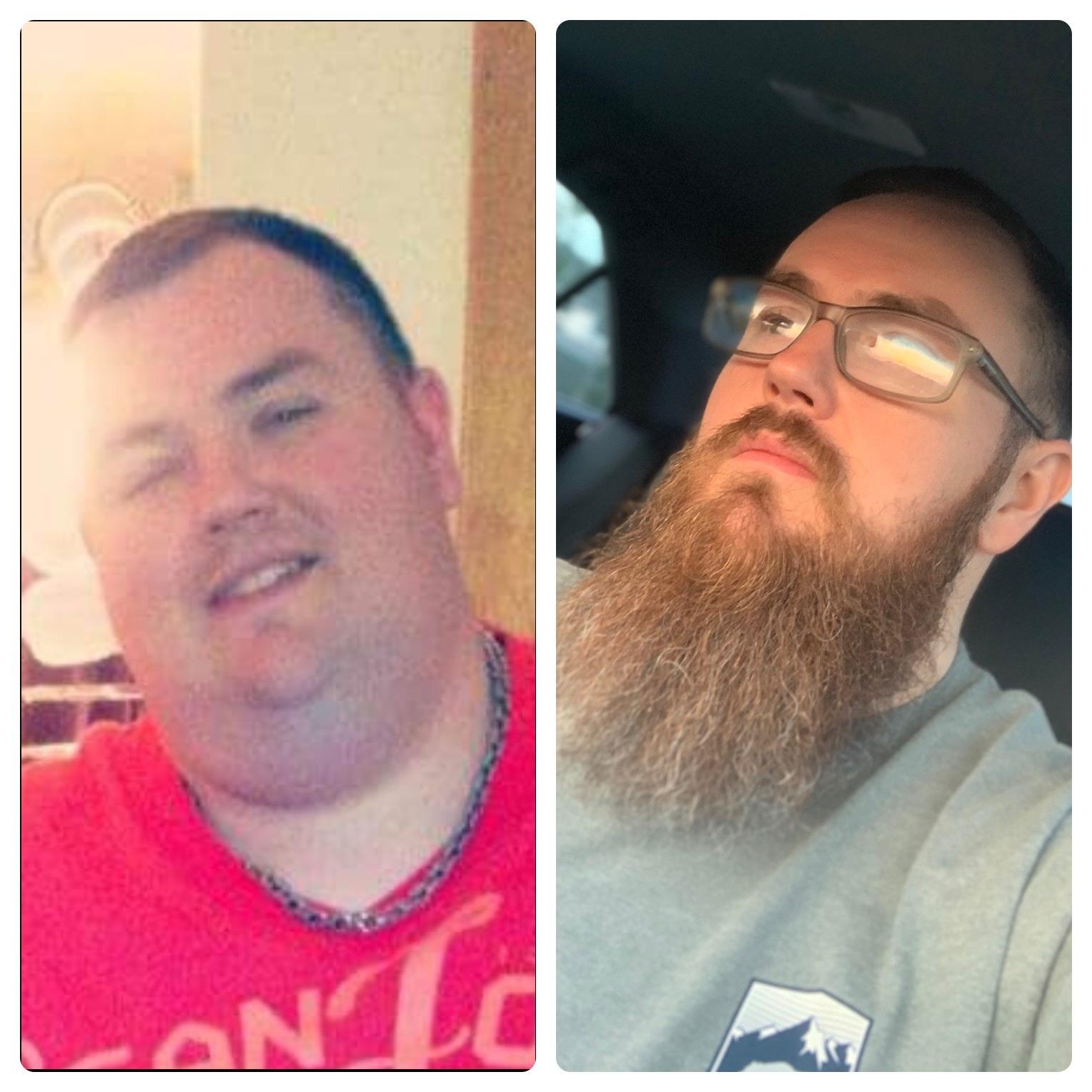 Lost 230lbs Gained A Yeard To Cover Up My Turkey